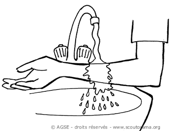 sd e no230 copyrightdr brulure2 48825