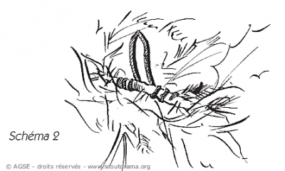 sd e no146 copyrightdr couronneavent schema2 afcd7